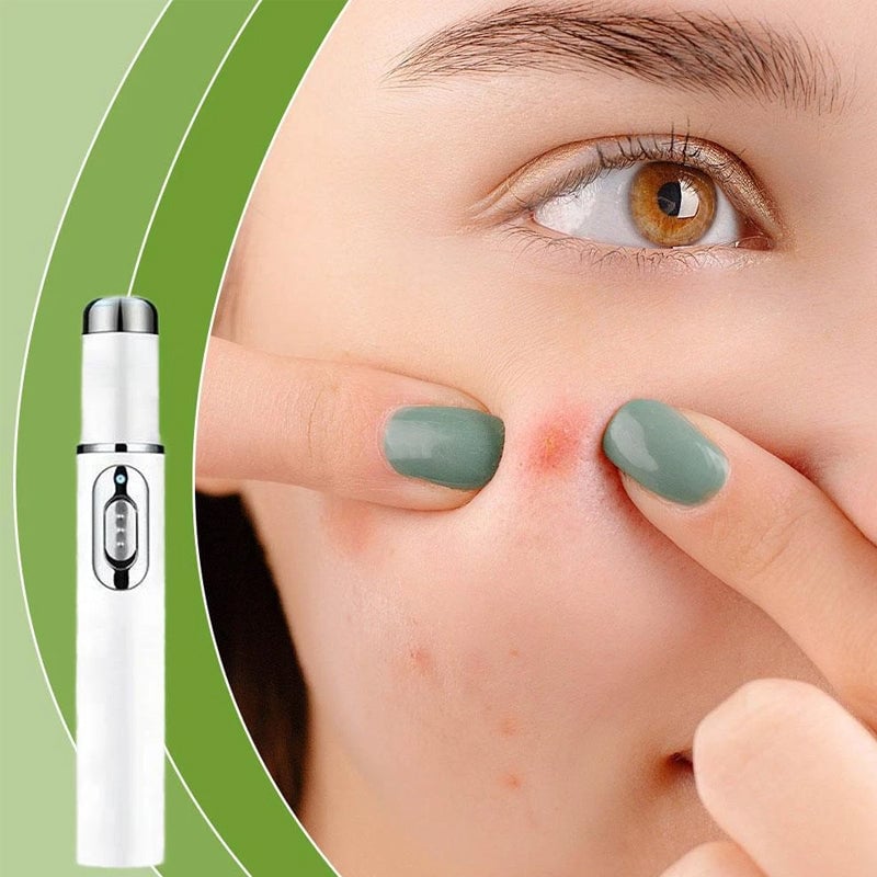 Niet-invasieve laserpen voor het verwijderen van moedervlekken en wratten