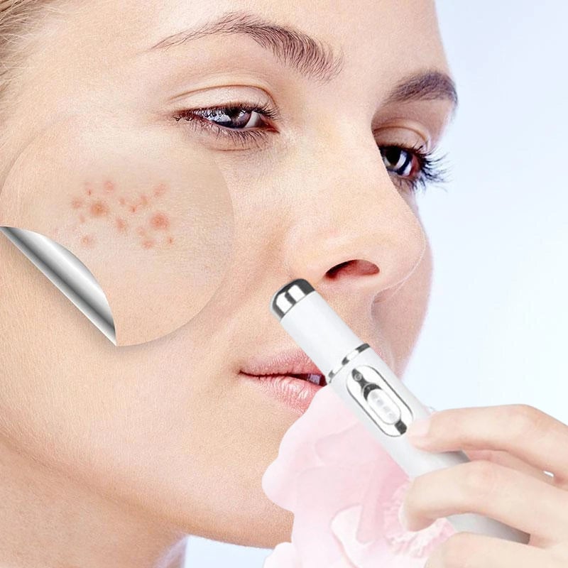 Niet-invasieve laserpen voor het verwijderen van moedervlekken en wratten